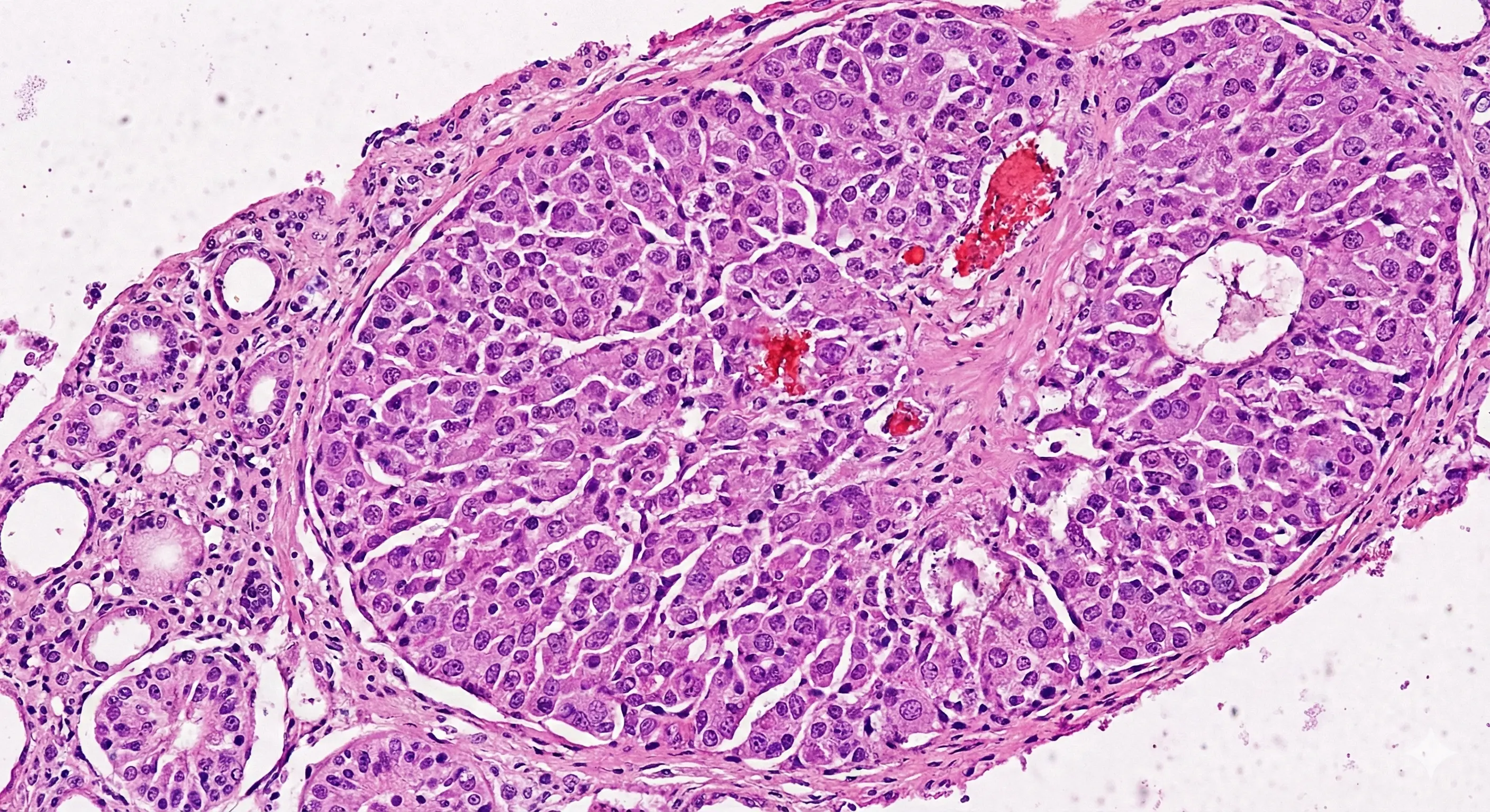 Pituitary Disorders